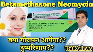 Betnovate N cream  Betamethasone Neomycin cream  betnovate n skin cream [upl. by Dnanidref153]