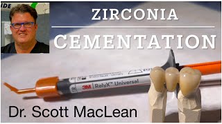 Zirconia Cementation with RelyX Universal Cement  Dr Scott MacLean  Dentist [upl. by Zipporah]