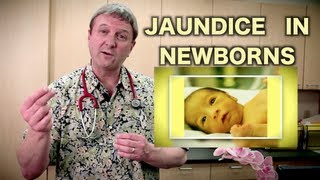 Jaundice in Newborns Pediatric Advice [upl. by Boni504]