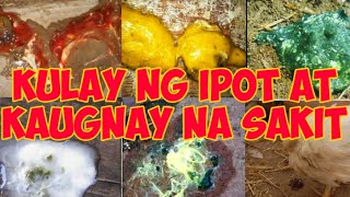 Kulay ng Ipot at Kaugnay na Sakit Anong Gamot [upl. by Merralee]