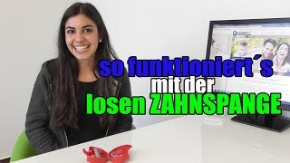 so funktioniert´s mit der losen ZAHNSPANGE  Orthodentix [upl. by Nnylyrehc501]