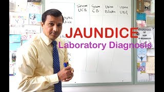 Jaundice  Laboratory Diagnosis [upl. by Llennahs]