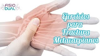 Ejercicios para FRACTURA METACARPIANOS huesos mano [upl. by Draneb]