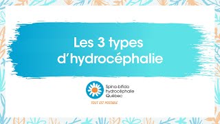 Les trois types dhydrocéphalie [upl. by Boyt263]