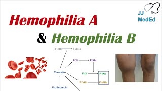 Hemophilia A vs Hemophilia B  Genetics Symptoms and Treatment [upl. by Mali]