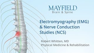 Electromyography EMG amp Nerve conduction studies NCS [upl. by Rianon]