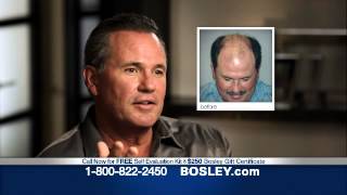 Hair Transplant Turkey  BBC Documentary  Paul Before amp After [upl. by Hameean]