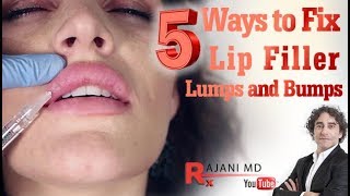 How to fix Lip Filler Bumps and LumpsWhy and How [upl. by Oribella46]