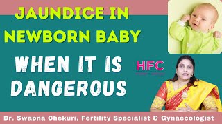 Jaundice In New Born Babies  Symptoms amp Treatment  Dr Swapna Chekuri  HFC [upl. by Eireva85]