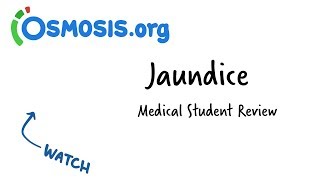 Jaundice  Clinical Presentation [upl. by Ianej]