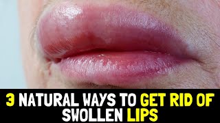 3 Natural and Inexpensive Ways to Get Rid of Swollen Lips [upl. by Hplar]