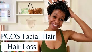 PCOS Facial Hair and Hair Loss  Causes Treatments amp Natural Ways to Reduce Hirsutism amp Hair Loss [upl. by Aivatnuhs708]