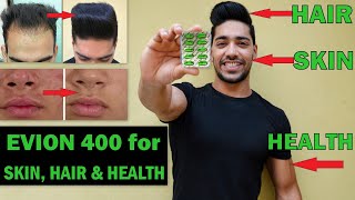 EVION 400  Uses SideeffectsBenefits for Skin Hair Bodybuilding Hindi [upl. by Annauj]