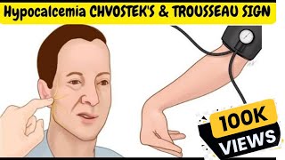 Hypocalcemia Signs and Symptoms  CHVOSTEKS amp TROUSSEAU SIGN [upl. by Ainwat374]