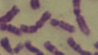 Cytogenetics Human chromosomes Karyotype [upl. by Dranik]