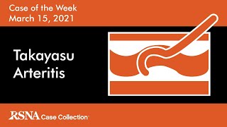 Case of the Week Takayasu Arteritis [upl. by Terrel]