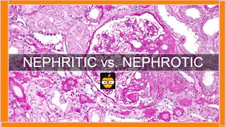 Nephritic vs Nephrotic Syndromes [upl. by Odnamla]