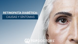 ¿Qué es la RETINOPATIA DIABETICA [upl. by Ahtibbat]