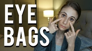 How to get rid of bags under eyes QampA with a dermatologist Dr Dray [upl. by Doran]