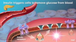 Understanding Type 2 Diabetes [upl. by Dralliw]