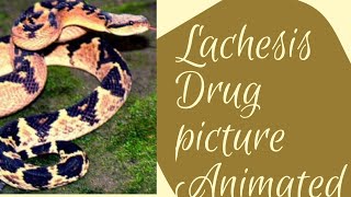 Lachesis Drug picture [upl. by Absa]