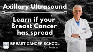 Breast Cancer Axillary Ultrasound Find involved nodes [upl. by Ahsauqal]