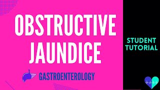 Obstructive Jaundice  Medical Tutorial [upl. by Tongue]