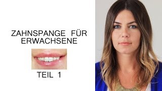 Zahnspange für Erwachsene  Der erste Schritt [upl. by Jump]