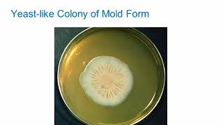 Dimorphic Fungi Sporothrichosis Hot Topic [upl. by Adnola860]