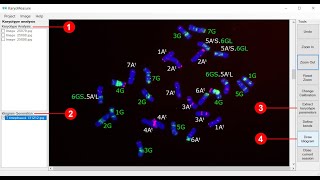 Karyotype analysis using KaryoMeasure [upl. by Aneerahs531]