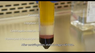 Isolate PBMCs with Lymphopure™ [upl. by Ramar266]