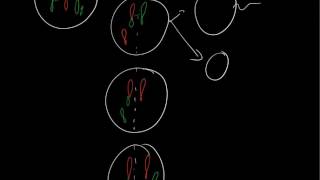 Robertsonian translocation 21q14q [upl. by Ofella268]