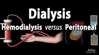 How a Dialysis Machine Works  Dialysis  ARTIFICIAL KIDNEYS [upl. by Rogers]