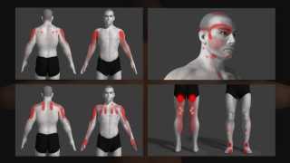 trigger point uitleg animatie Dutch [upl. by Odeen]