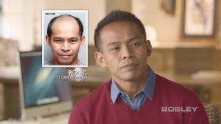 Bosley Hair Transplant Patient Review  Ron C [upl. by Orgalim608]