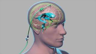 Cardiac Conduction System  Cardiology [upl. by Marcellus]