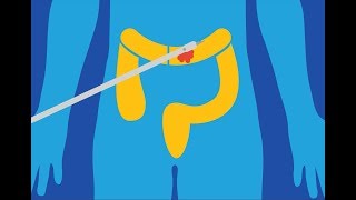 True Colon  The Modern Colon Hydrotherapy Process [upl. by Wehtta]