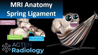 Spring Ligament Complex MRI Anatomy [upl. by Adnof278]