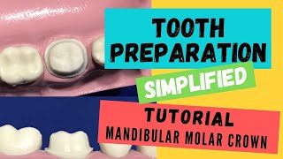 Zirconia Crown Preparation DEMONSTRATION Super Simplified [upl. by Ylerebmik]