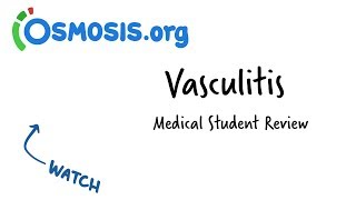 Vasculitis  Clinical Presentation [upl. by Assilac]