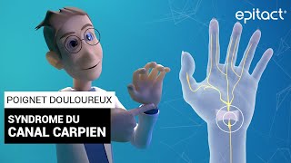 Syndrome du Canal Carpien  Explications – EPITACT [upl. by Auohc]