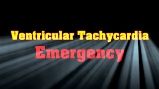 Symptoms and Causes of Ventricular Tachycardia [upl. by Phenica183]