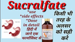 Sucralfate suspension  Uses Side effects Dose and precautions In Hindi [upl. by Berenice]