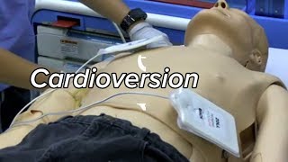 Cardioversion  Defibrillation Technique [upl. by Akemrehs]