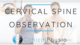 CERVICAL RADICULOPATHY Common Symptoms and Treatment Options  Dr Javier Reto [upl. by Sinne864]