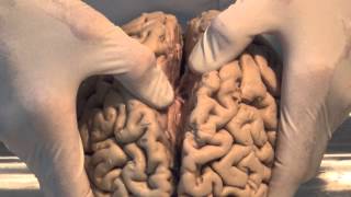 Introduction Neuroanatomy Video Lab  Brain Dissections [upl. by Behlke]