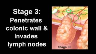 The Truth About Colon Cleanses A Doctor Explains [upl. by Loram764]