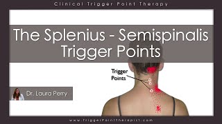 The Splenius and Semispinalis Trigger Points [upl. by Peg]