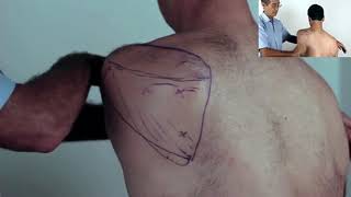 Trigger Point Master Class  How to Release Infraspinatus [upl. by Amme]