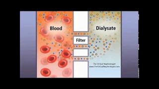 Hemodialysis Hemofilter and countercurrent animation [upl. by Schiro]